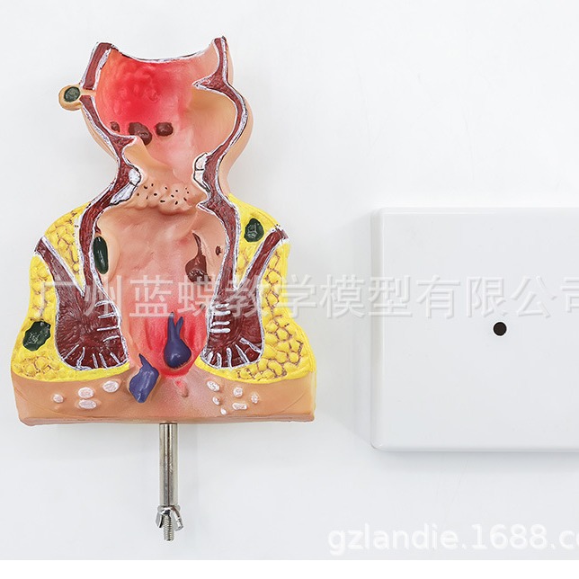 רҵ�ع�ֱ������ģ�� ����ֱ������ģ�� ��¥̽�� �̴�ģ�� ����