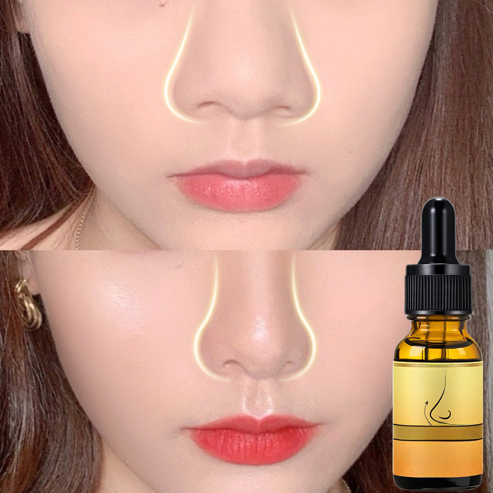 美鼻液 10ml按摩鼻子精油 Nose care essential oil 立挺鼻子油
