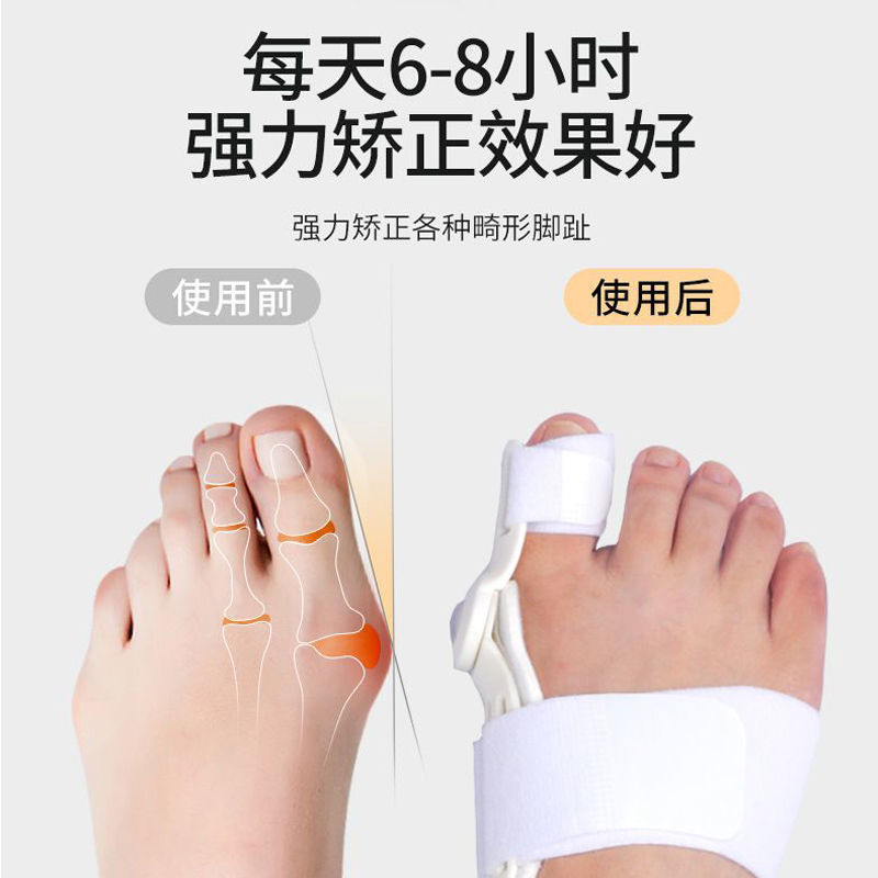 Orthotics for toes, bracket
