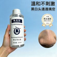 ��ͷ����Һȥ��ͷ�տڷ۴��������ë������Ժ����С����ȥ��ͷˮ