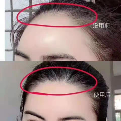 細胞育毛外分泌体凍結乾燥粉に妊娠発健髪を塗布して毛包微結晶を強化し、濃密に太くする