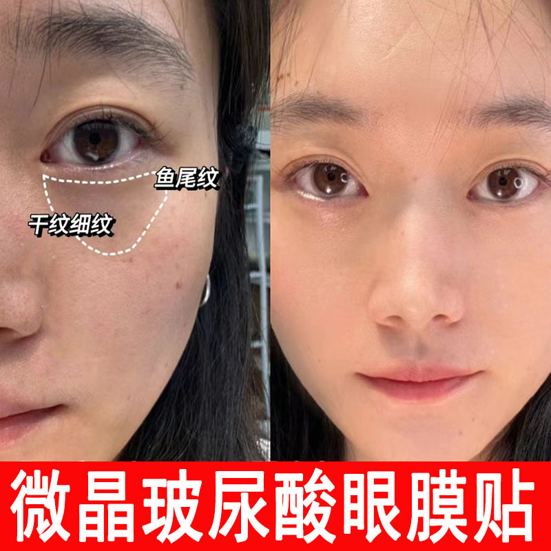 微针眼膜贴抚平眼周细纹眼纹去眼袋黑眼圈紧致提拉抗皱微晶眼贴膜