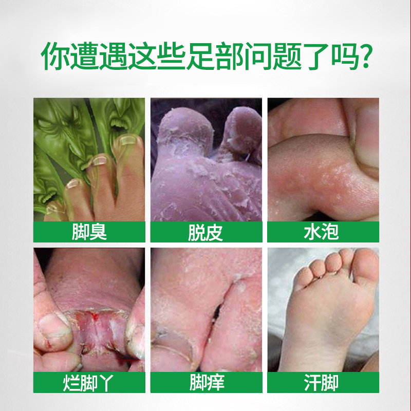 现货足光散 泡脚粉  足光粉 脚臭粉 脚痒  脚臭 脚汗足浴粉批发|undefined