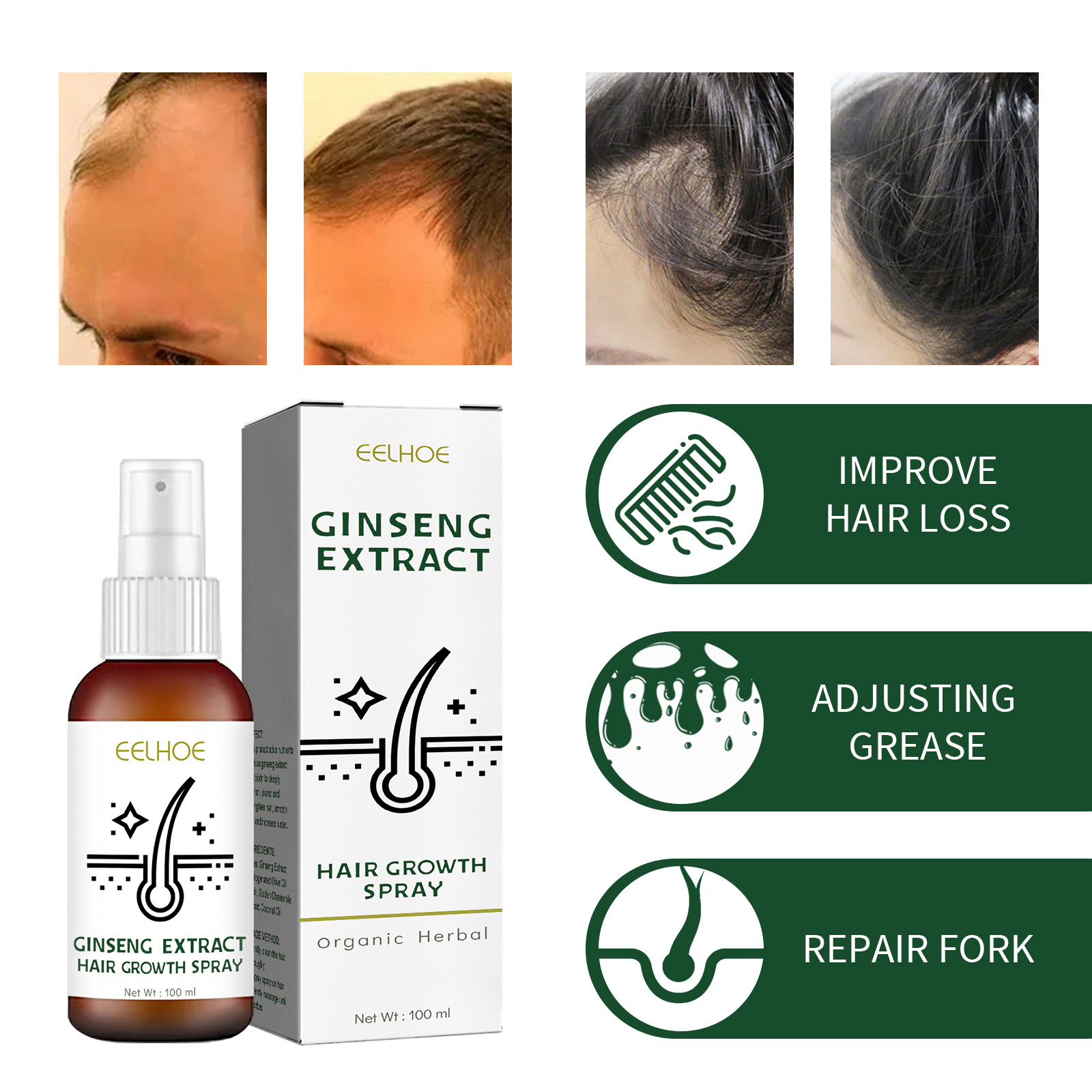 EELHOE ženšenniga juuksepaksuse sprei, juuksehooldus ja juuksehoolduse parandamine, juuksehooldus, niisutav ja juuste väljalangemise vastane toitev sprei_voghion.com