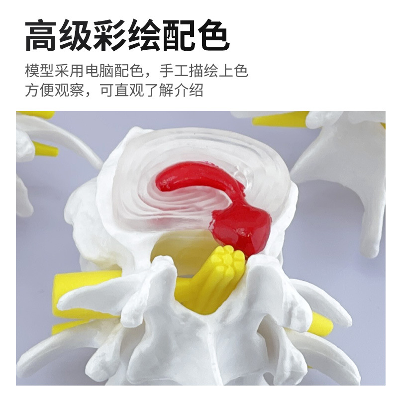 �ķ��ͼ�׵�����벡����׵���ģ�� ׵���̲�����׵��ʾ���� ����