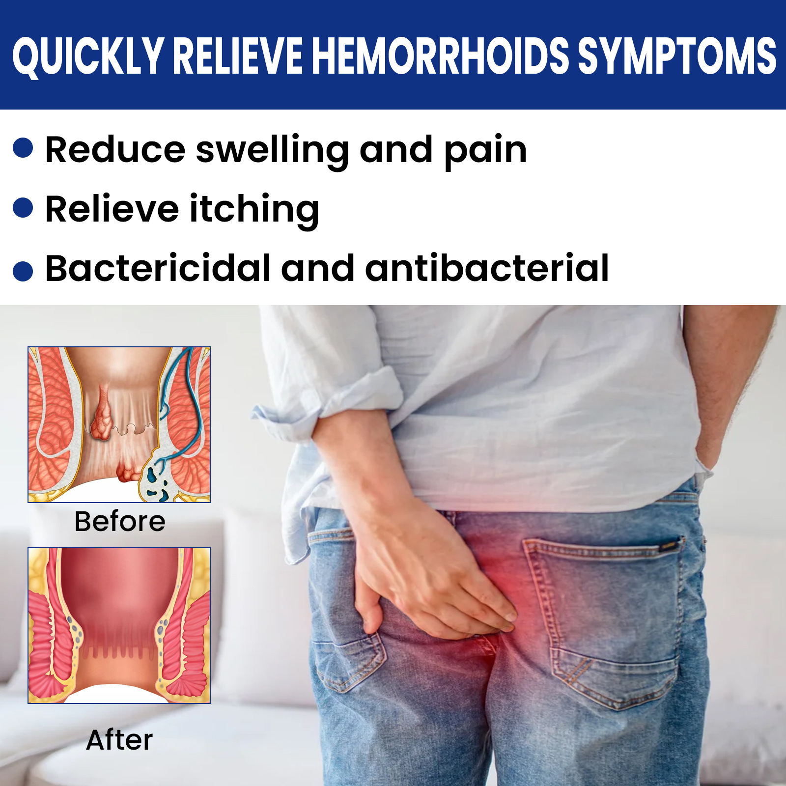 Lindert sanft gemischte Geschwüre innen und außen, gebrochene Fleischbällchen, Thrombosen, Hämorrhoiden, Hämorrhoidencreme_voghion.com