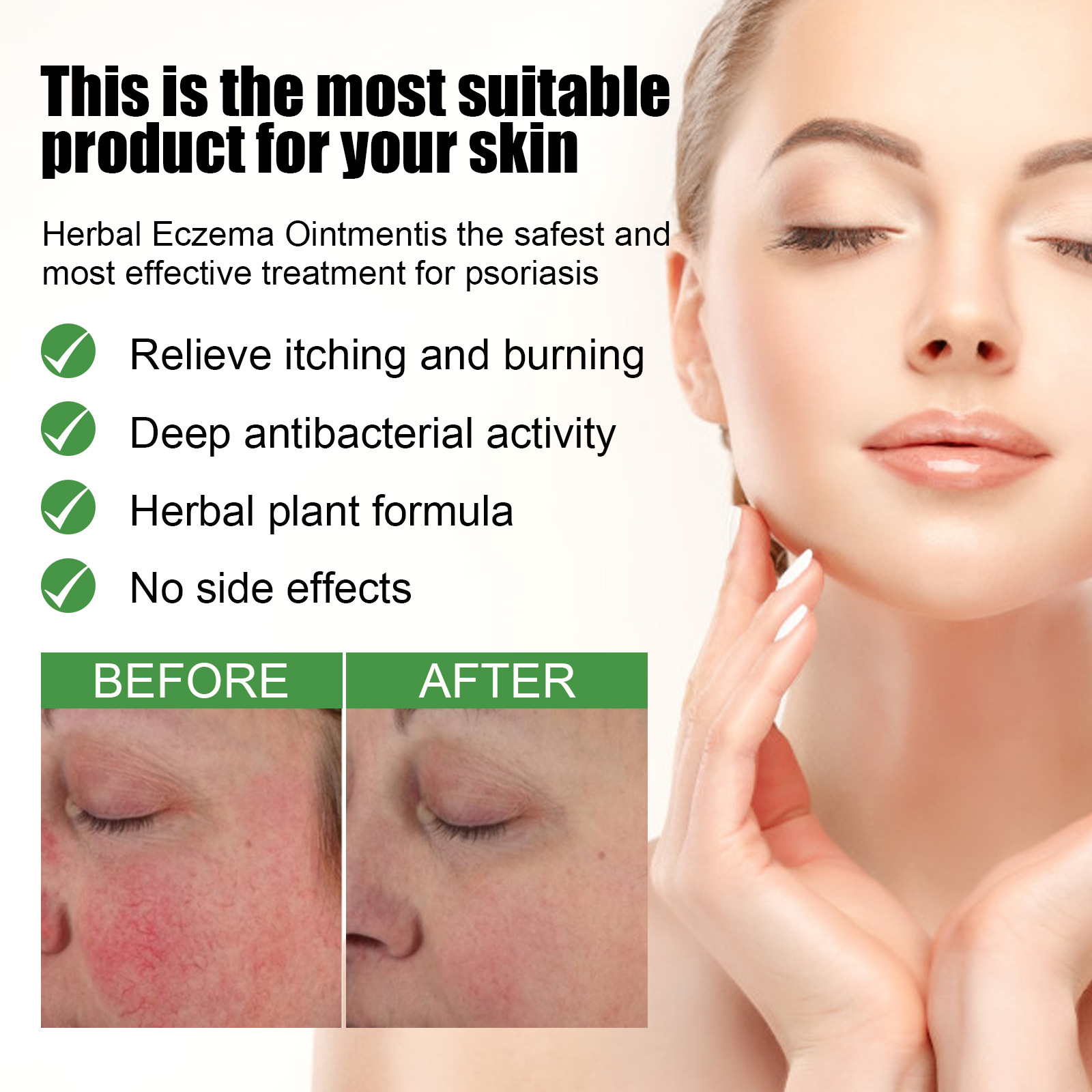 South Moon Skin Care Ointment Relieve Redness and Itching of Hand and Foot Dermatitis Skin Repair Ointment_voghion.com