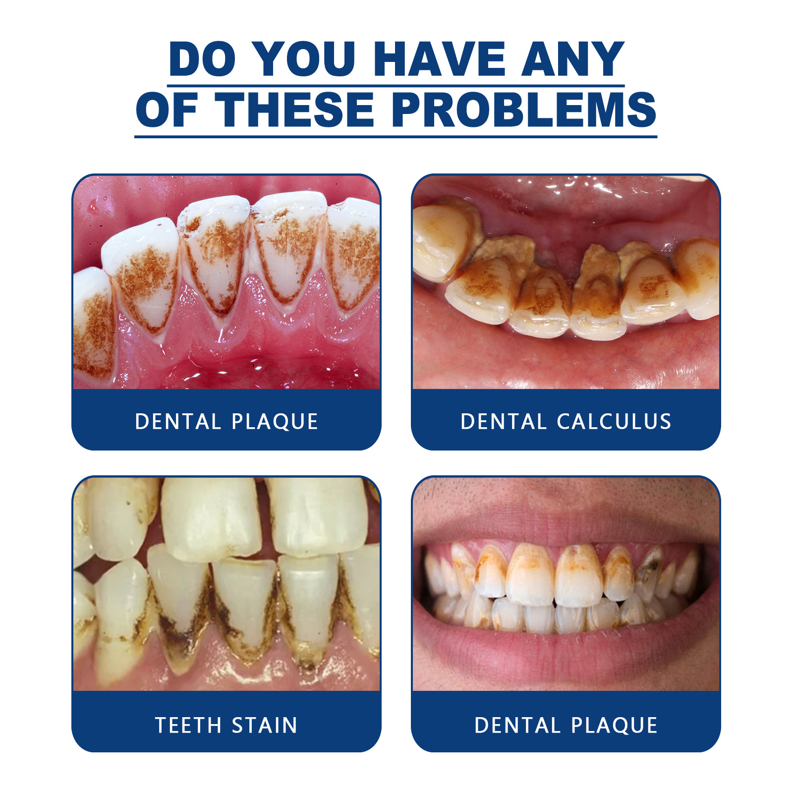 Jaysuing牙石溶解口腔噴霧 持久留香味溶解遬牙結石口臭牙垢