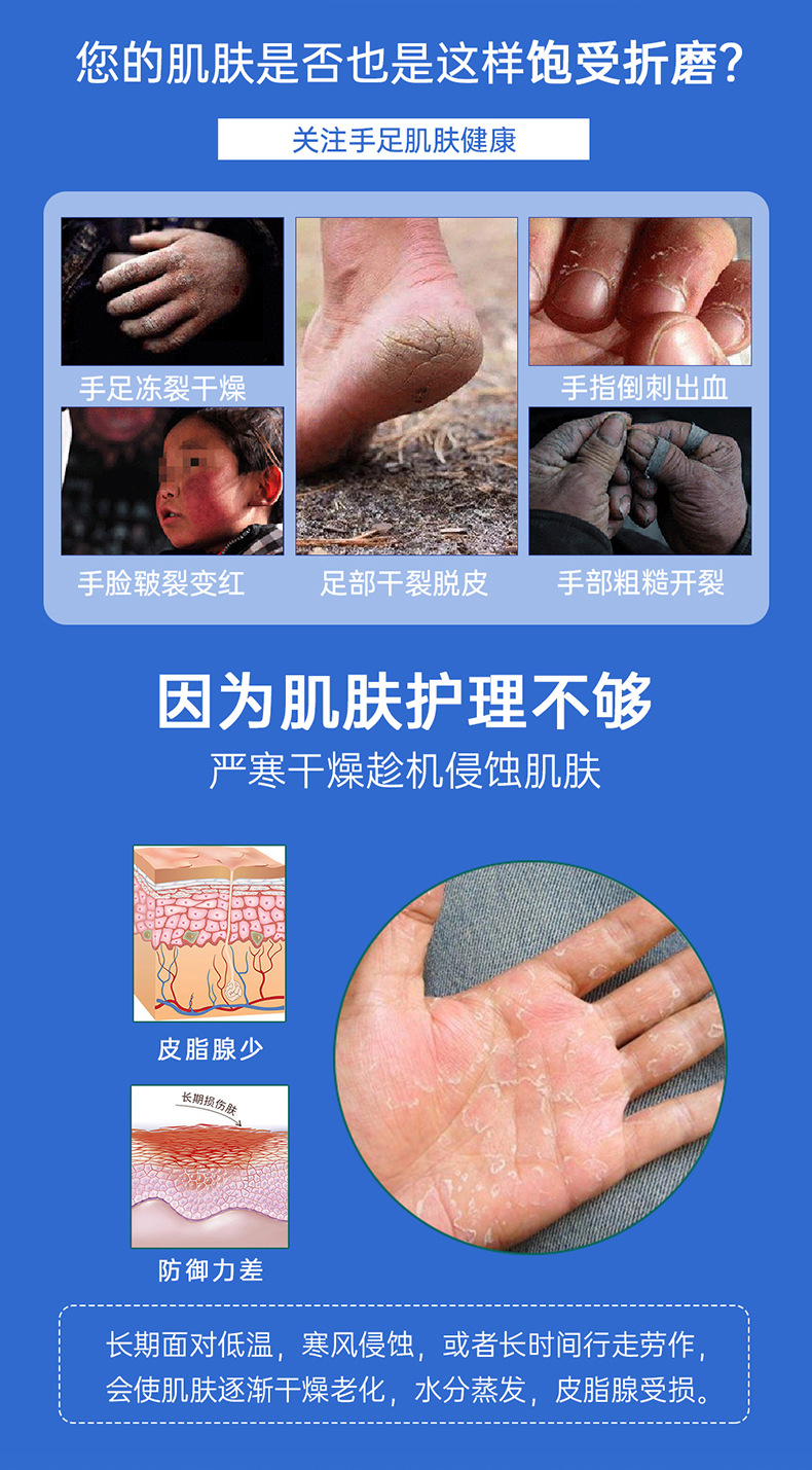 Aixima Lekening Moisturizing Cream, hand cream, anti-freezing, anti-cracking heel, moisturizing and hydrating hands and feet. Domestic products details Picture