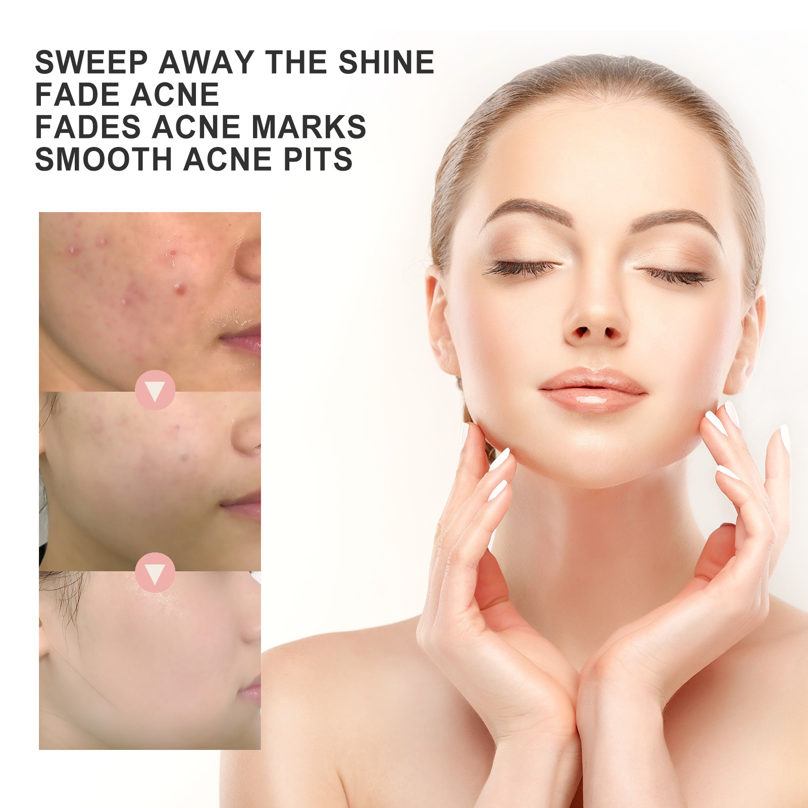 OUHOE – Patch réparateur de rougeurs du visage, nettoyant les Pores, hydratant et lissant, Patch contre l'acné de la peau_voghion.com