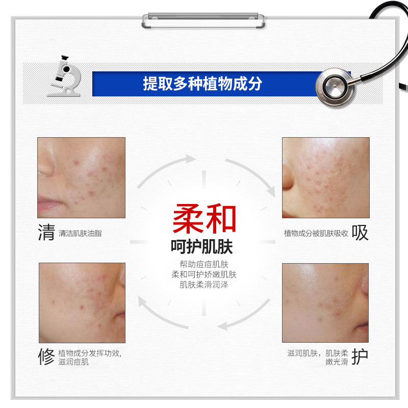 Crema Facial Anti-Acné e Hidratante, Anti-Acné, Hidratante, para Rostro