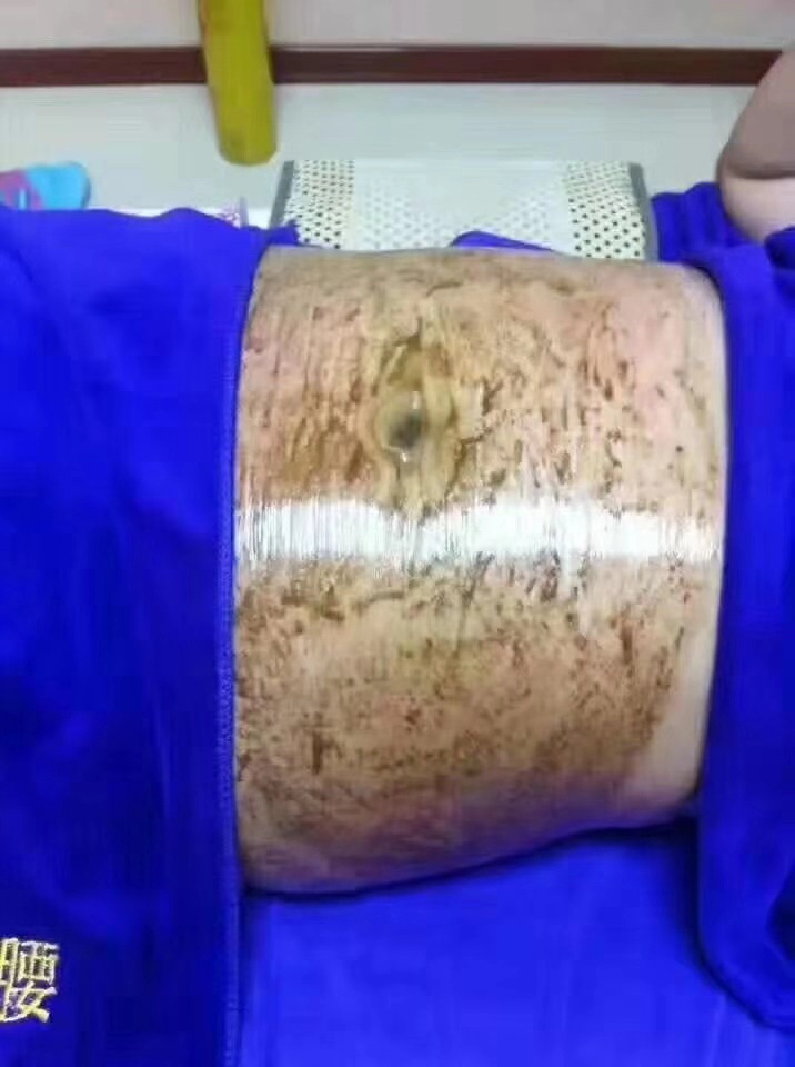 详情图