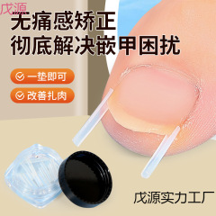 炎矫正器正甲贴纠正脚趾甲指甲贴片嵌甲垫片甲沟往肉神器填充里长
