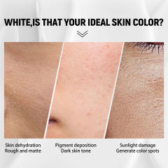 eelhoe Moisturizing Cream, Nourishing Hydrating Skin Care Cream, Brightening the Skin, Whitening, Hydrating, Easy Absorption Facial Cream