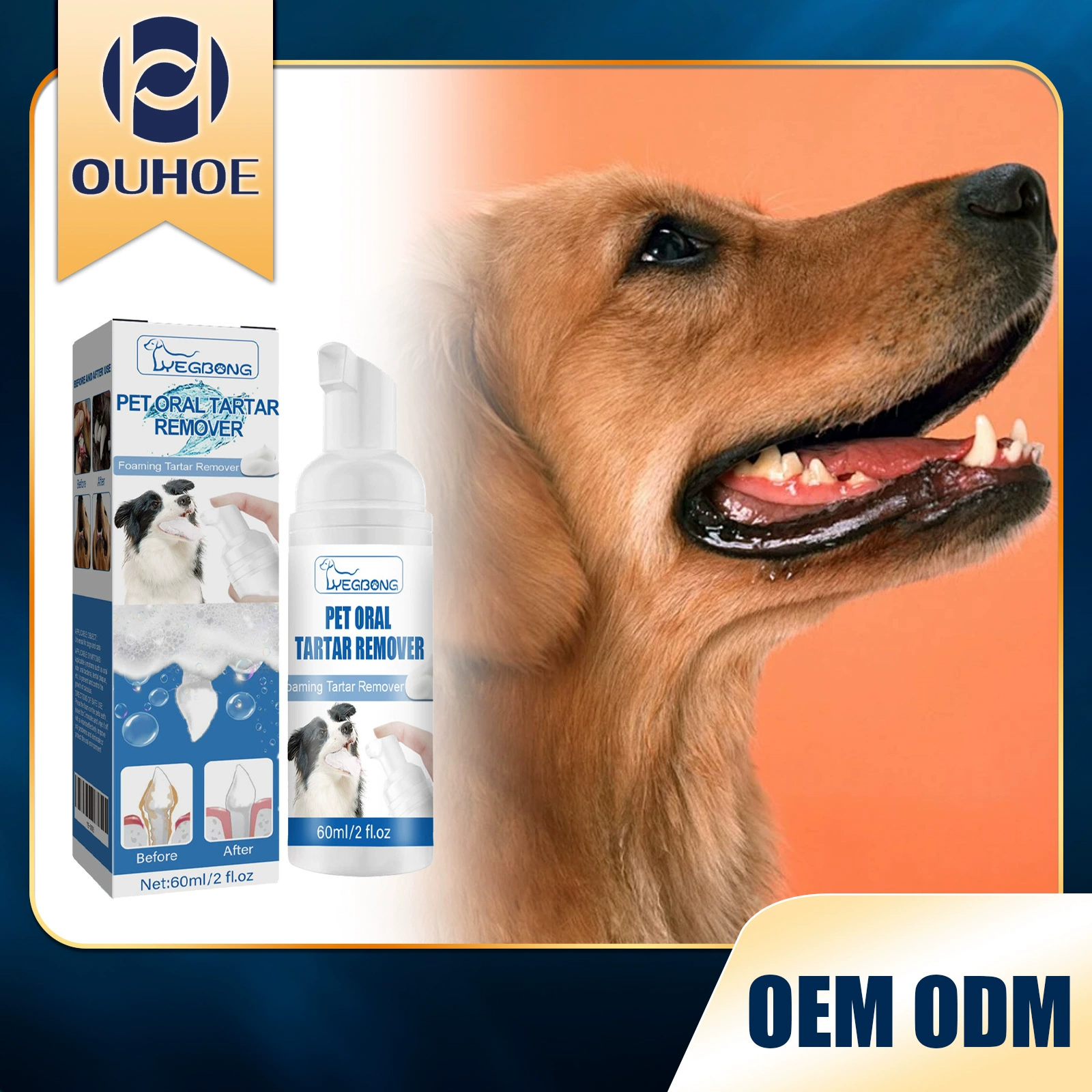 Средство для удаления зубного камня Yegbong очищает зубной налет, желтые зубы, устраняет неприятный запах изо рта, очищает зубы, пенка для чистки полости рта.