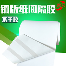 �g���z���϶��ƾֲ����z���z�˺��N��ԭ�����~�漈�g�������z�S��