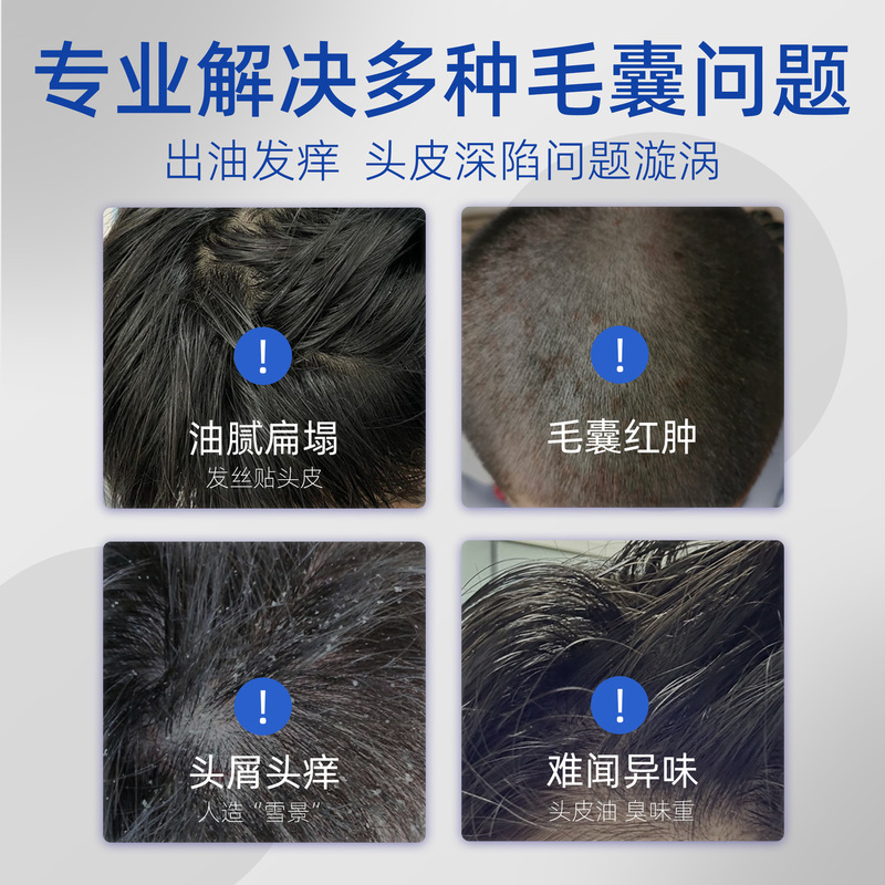 正友製薬 石炭焦油ヘッドオイル 頭皮のかゆみ・フケ対策 オイルコントロール洗浄剤 オリジナルブランドのカスタマイズ・卸売対応|undefined