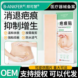 邦可慧医用硅凝胶祛疤贴双眼皮手术疤痕去疤贴剖腹产烫烧伤减张贴