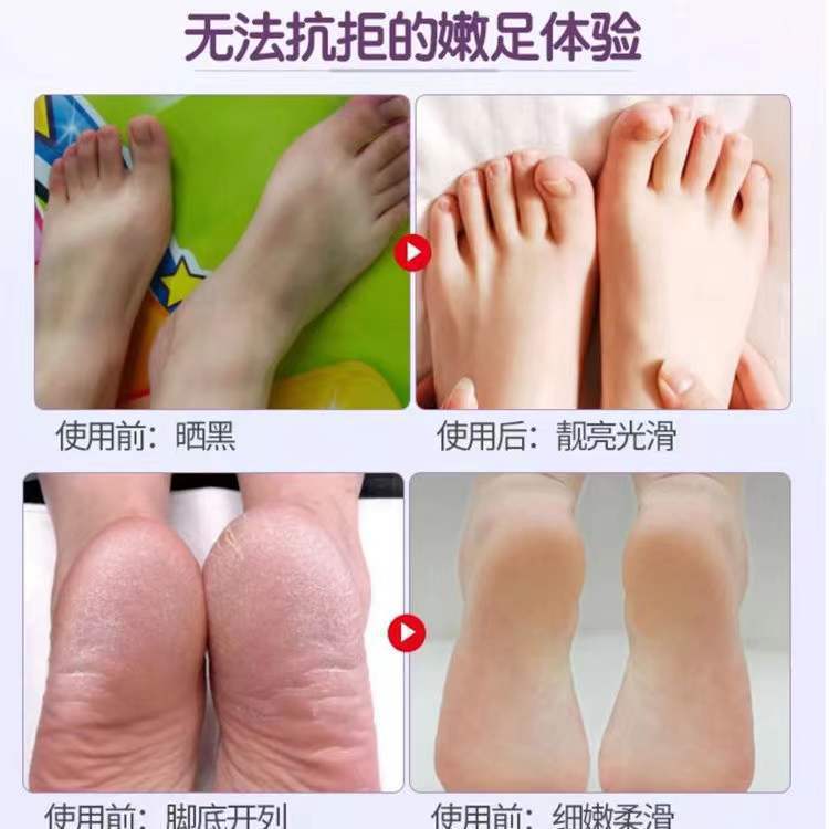 足のカバーの使い捨ての柔らかい白い保湿のかかとの乾燥した皮の馬油の足の膜は皮の角質の古い繭を取り除いてLOGOを決めます。|undefined