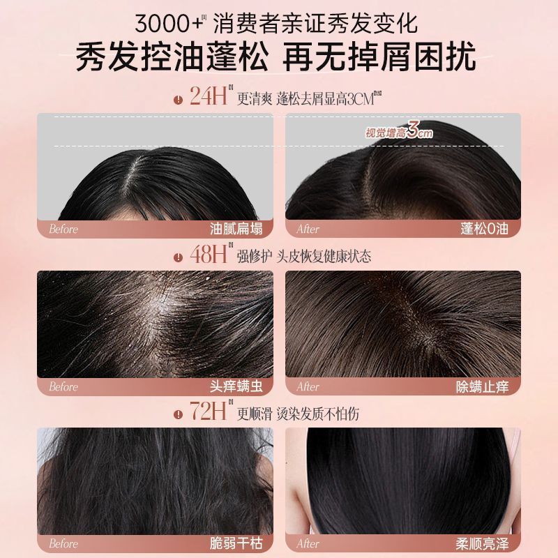 二硫化セレン ファットドンライ シャンプー フケ防止 かゆみ止め オイルコントロール 香水タイプ 持続性のある香り シャワージェルセット 正規品|undefined