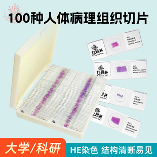 �����@΢�R��Ƭ�^��100�NFRT2002�߽����w���ﲣƬ����Ҳ���˱�
