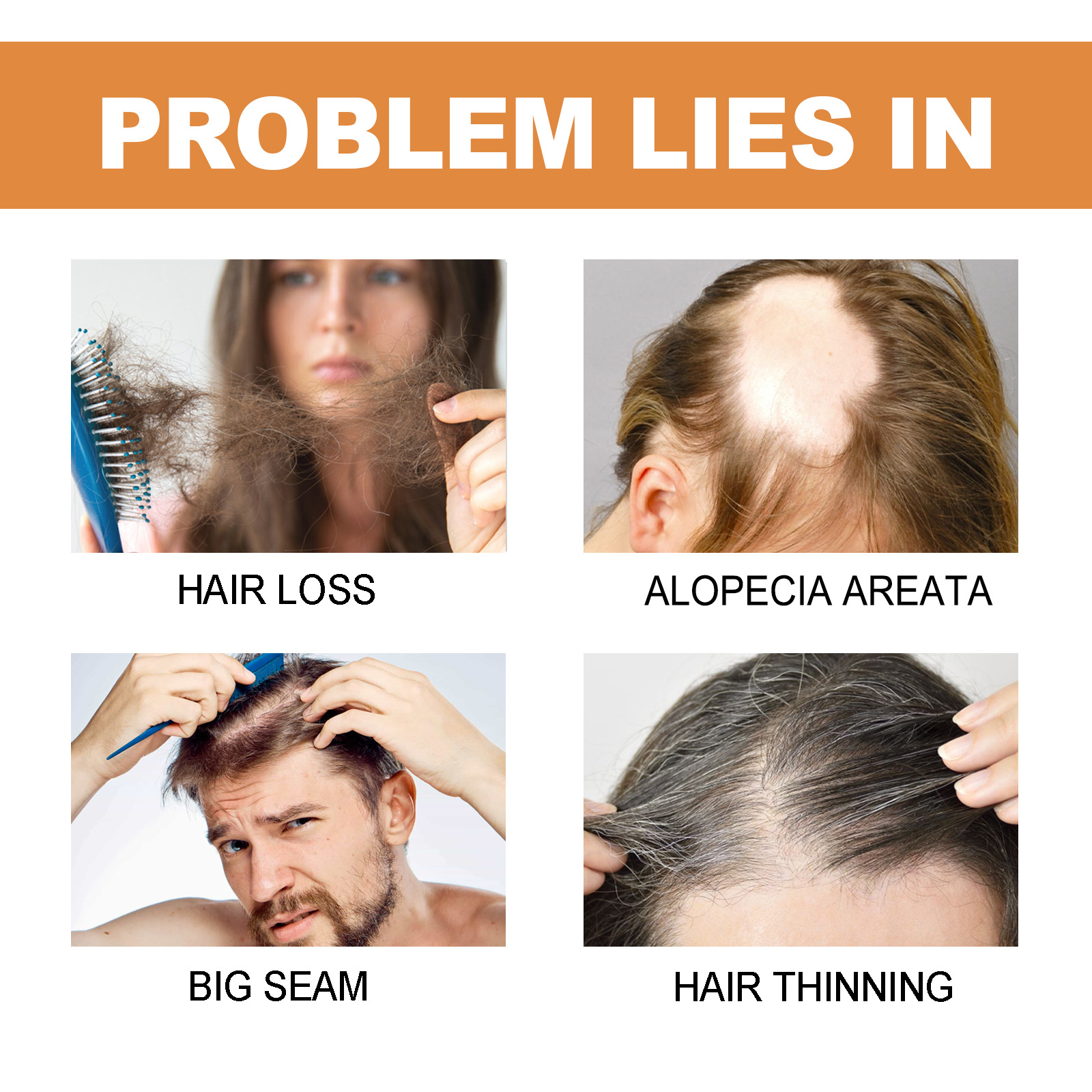 EELHOE Bieziem matiem ampula Spēcīga matu atjaunošana Pret matu izkrišanu Sakņu stiprināšana Biezu matu kopšana Galvas ādas masāža_voghion.com