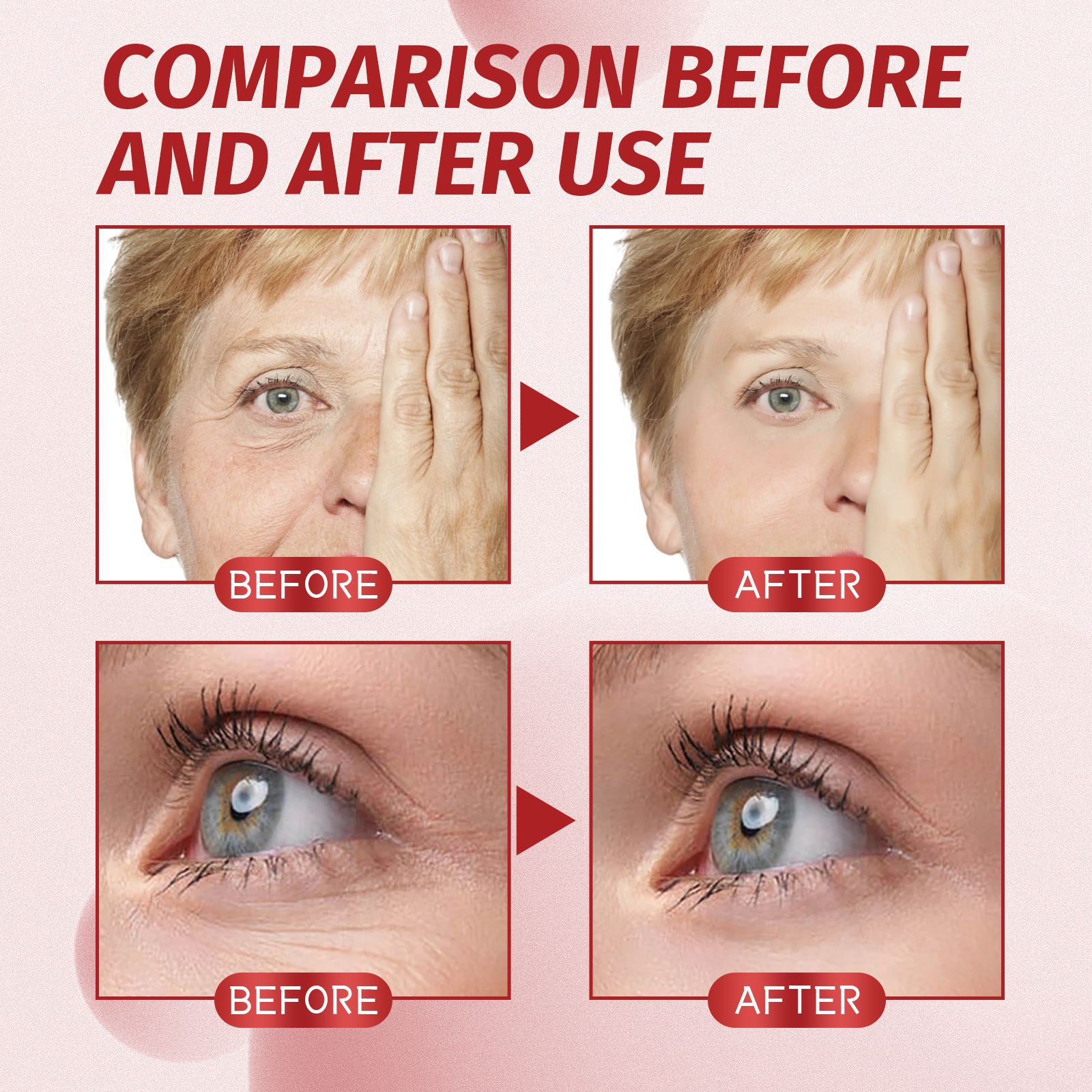 EELHOE Moisturizing Anti wrinkle Attenuates fine lines on face, prevents aging, softens skin, tightens the wrinkles,_voghion.com