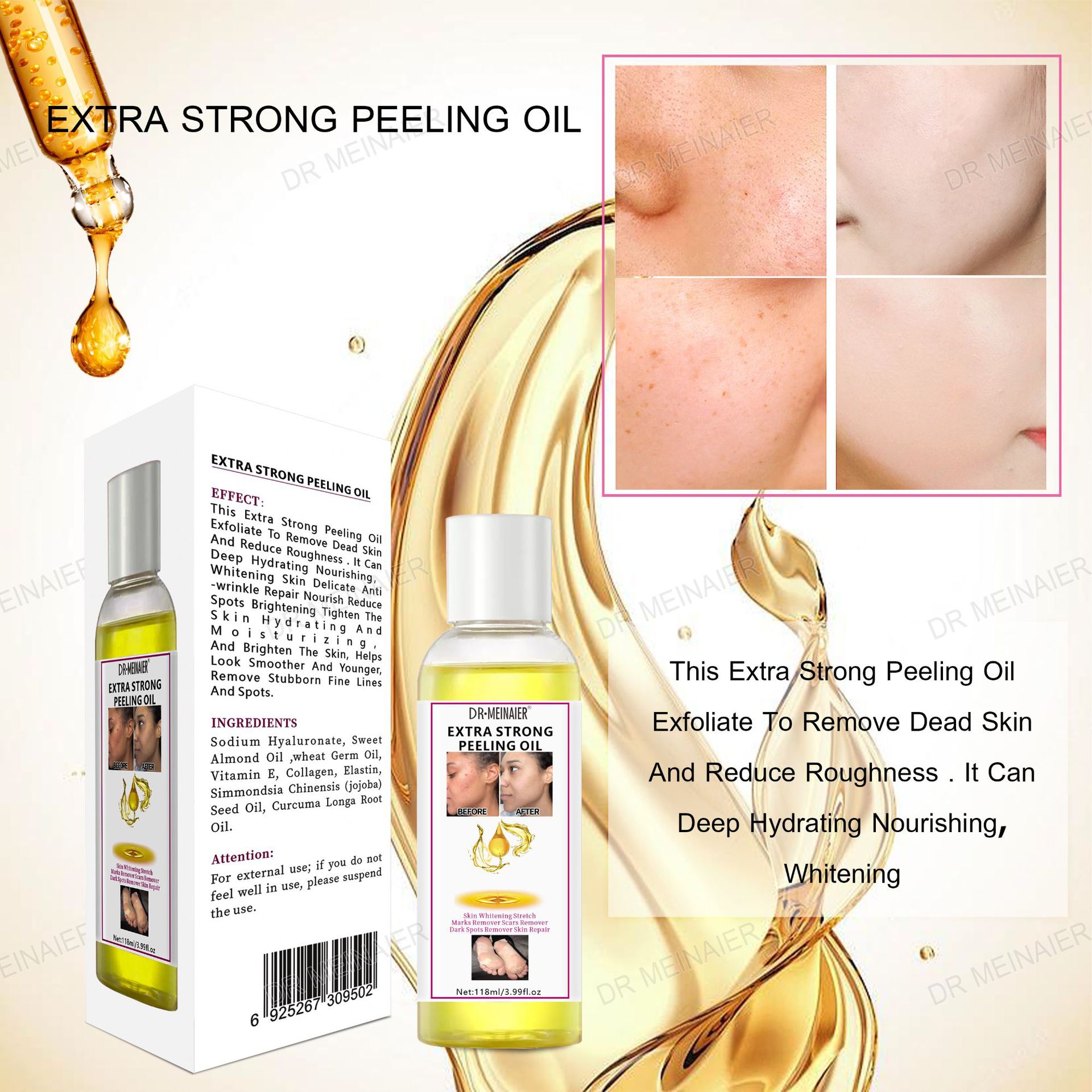 0105aeea05253185cc0645aa7b6657