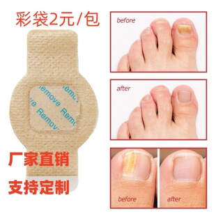 �羳ָ���N���o�C���N��ָ���N���z�㲿�o���לϰl���־��N�o���N
