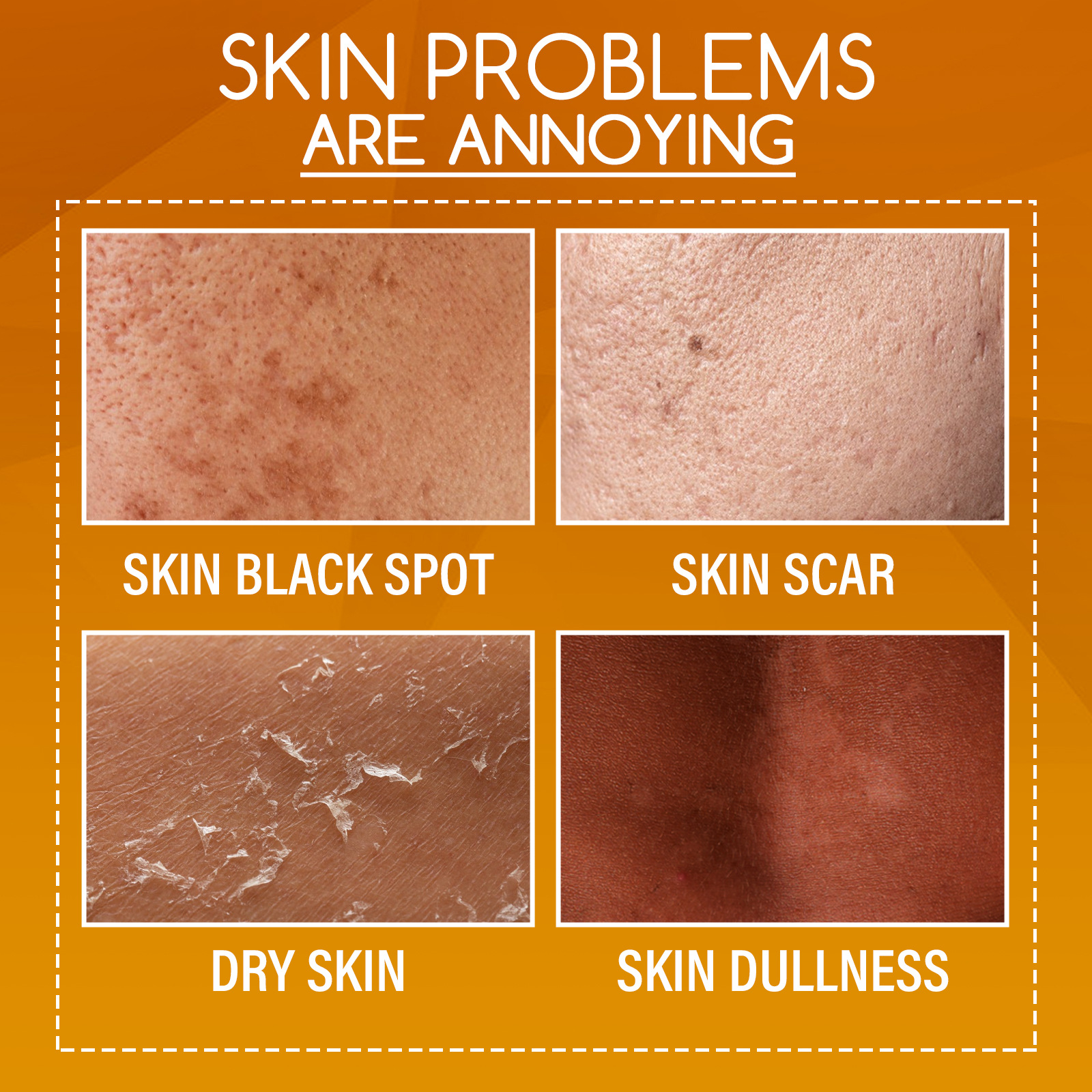 OUHOE Orange kūno losjonas šviesina juodas dėmes ir balina Drėkinamasis švelnus šveičiamasis odos priežiūros skystis_voghion.com