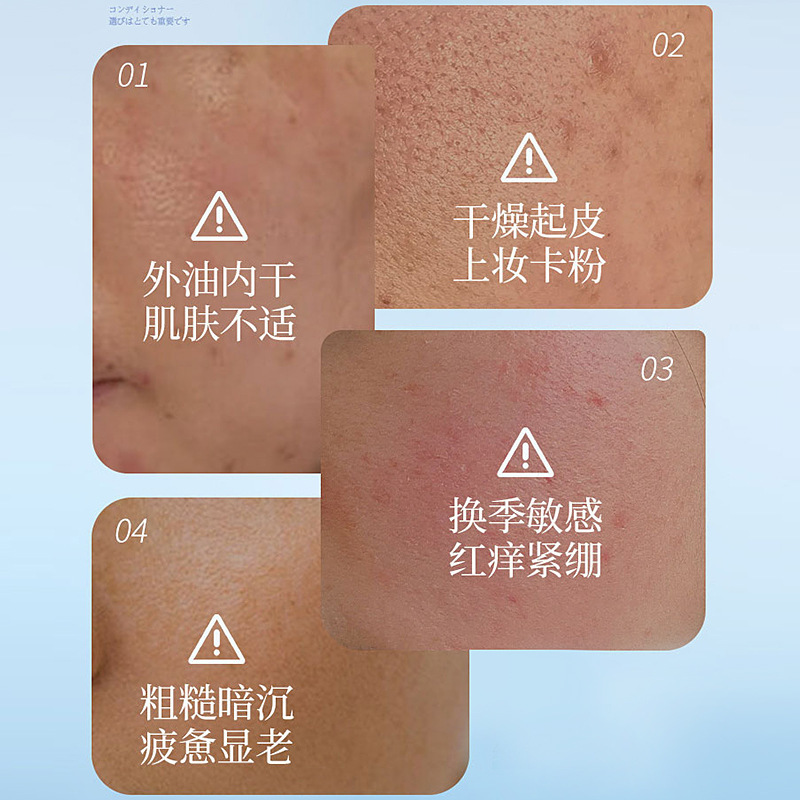 雅瑞欣 プロビタミンB5 鎮静保湿化粧水 男女兼用 湿布 フェイシャルスキンケア用品 化粧水|undefined