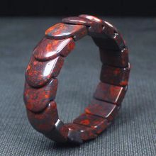 ��Ȼ�t����������Ź����uѪʯ�ִ���Ů���uѪ���Eʯֱ��؛Դ���l