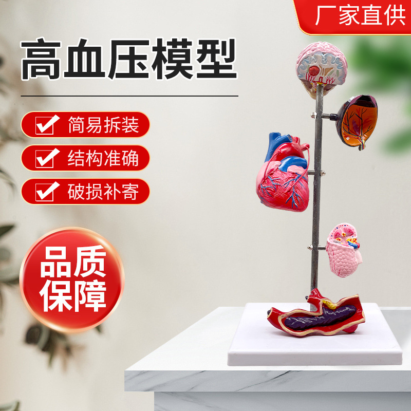 Manufacturer wholesale hypertension model medical model medical…