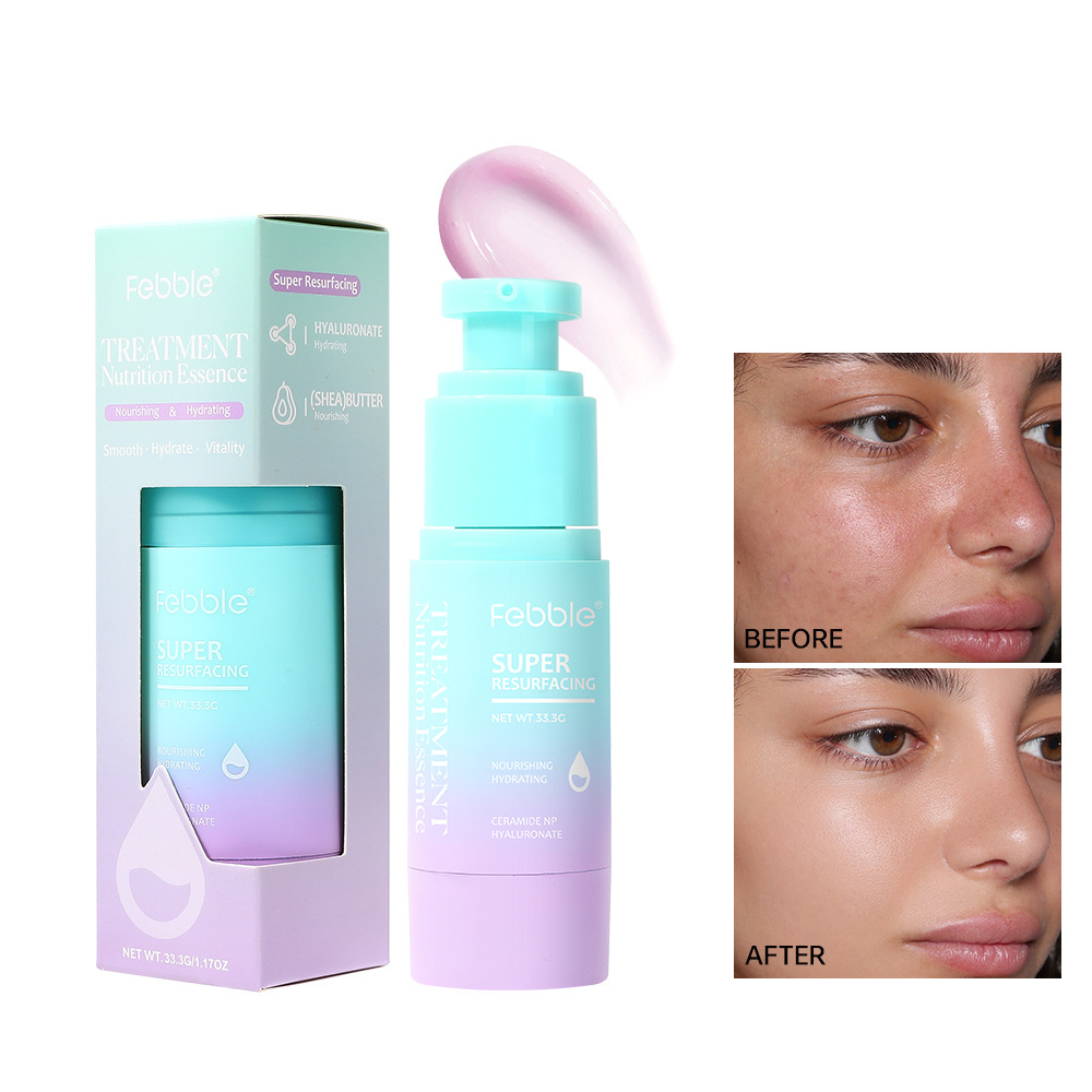 Febble spot transfronterizo venta caliente espuma limpiador facial de mousse limpieza profunda
