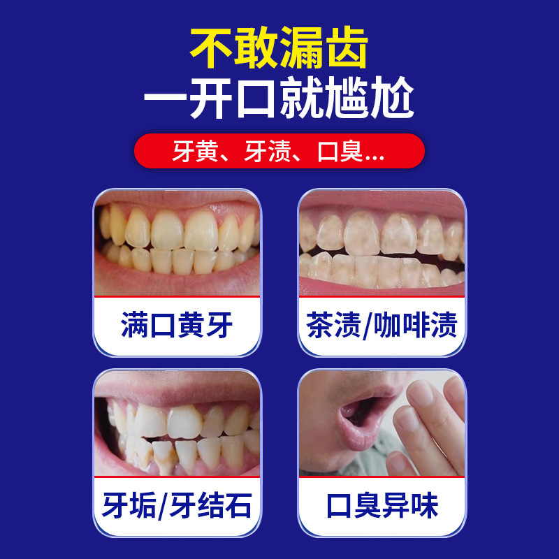 プロバイオティクスホワイトニング歯磨き粉は、歯石、口臭、臭いを除去します。卸売プロバイオティクスオーラルケア歯磨き粉|undefined