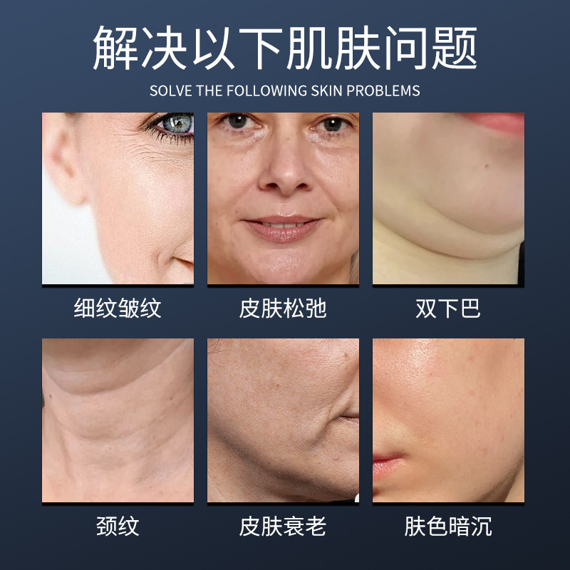 Volnewer黄金椿面部提拉淡化皱纹改善松弛提升紧致美容院仪器抗衰|undefined