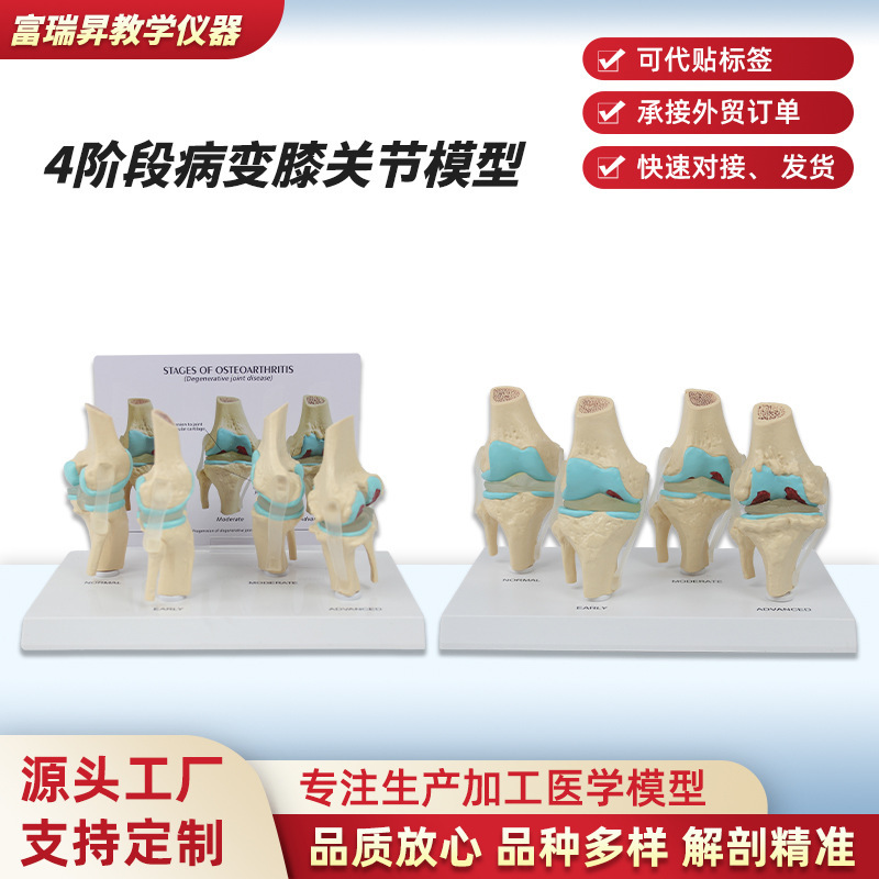 Human Knee Joint Model of 4 Stages, Knee Joint Evolution Demonstration Model, Bone Joint Display Teaching Aid Manufacturer Human Knee Joint Model of 4 Stages, Knee Joint Evolution Demonstration Model, Bone Joint Display Teaching Aid Manufacturer