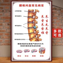 人体骨骼结构图中医脊椎常见病宣传挂画腰椎相关墙贴纸海报