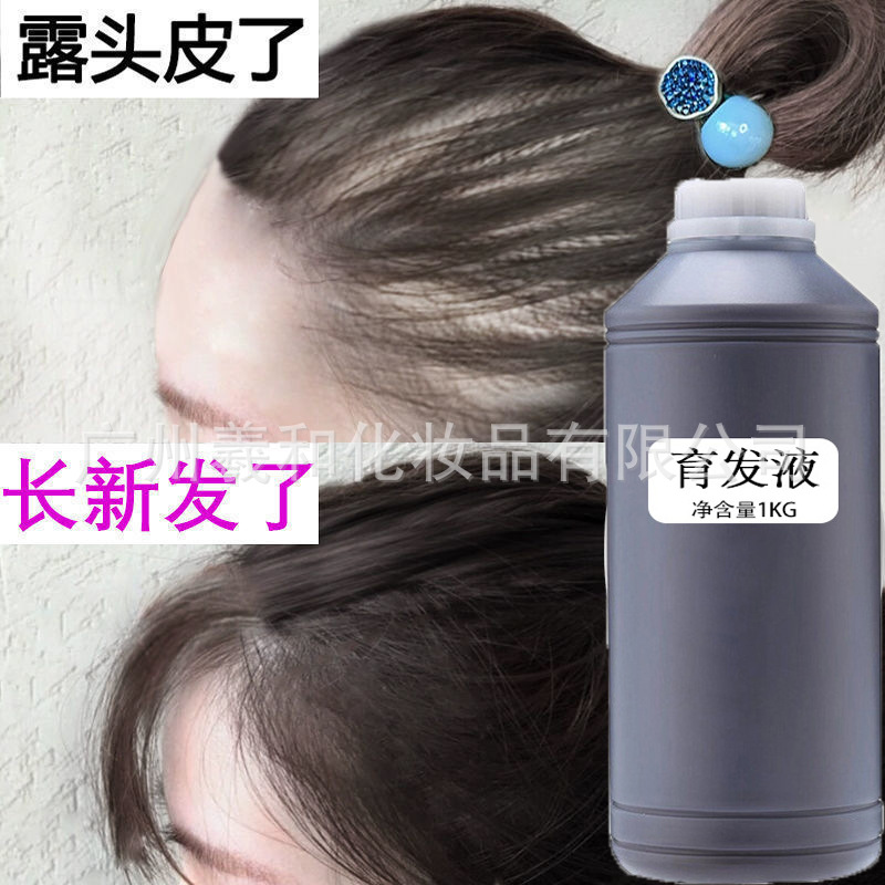 生发液激活毛囊头发猛长男士快速长发育发增发防脱增发剂育发液