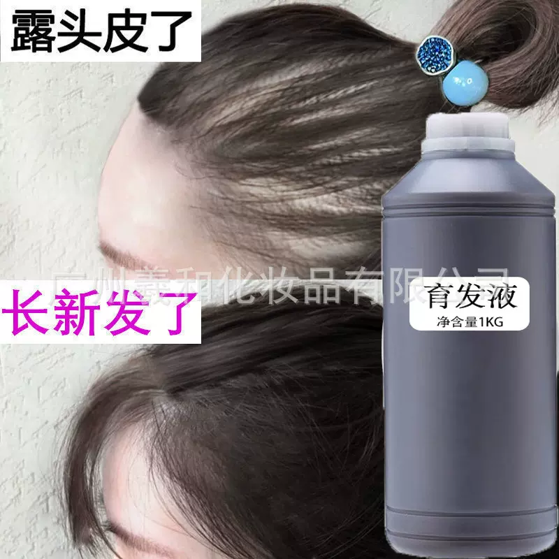 生发液激活毛囊头发猛长男士快速长发育发增发防脱增发剂育发液