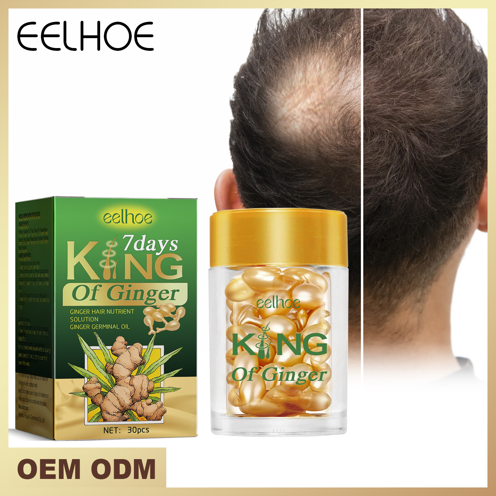 Ginger Dense  Capsules for Nourishing Moisturizing Hair Roots, Strengthening Hair, Preventing Scalp Loss           ,_voghion.com