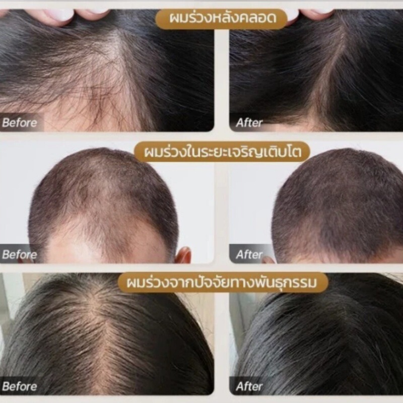 Hair Tonic Prevent Hair液 头发防护液|undefined