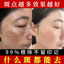 �o�����������˪����Ժ��������׺п�ɫ���������Һ�ֽ��ɫ��