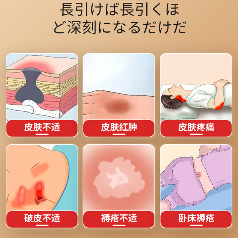 长久卧床肌肤破皮褥疮疼痛不适坂枝野寻牌褥疮膏外用保健膏批发|undefined