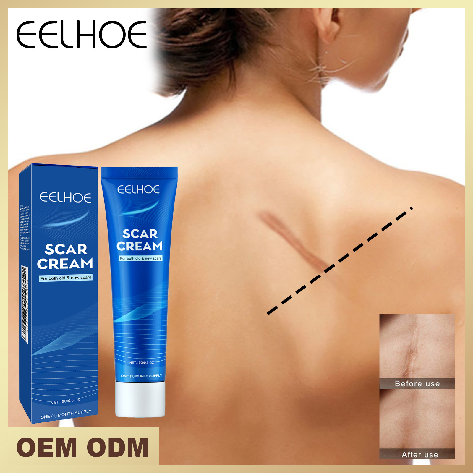 Eelhoe Skin Care Cream Gentle Care External Body Care Moisturizing Smoothing Skin Care Application Cream