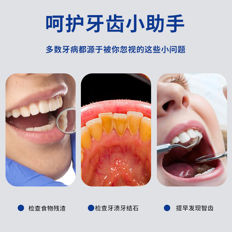 LED防霧口腔鏡牙齒內窺鏡看牙工具口鏡帶燈雙光源充電發光檢查鏡