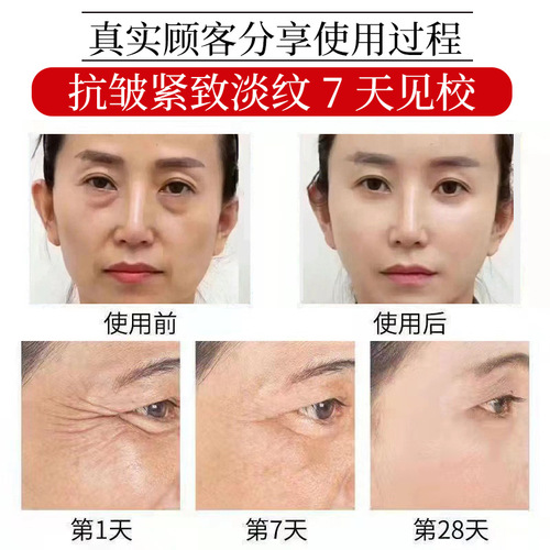 Rich in 7 types of collagen restructuring cream, anti-wrinkle, firming, repair, moisturizing and rejuvenating collagen cream beauty salon