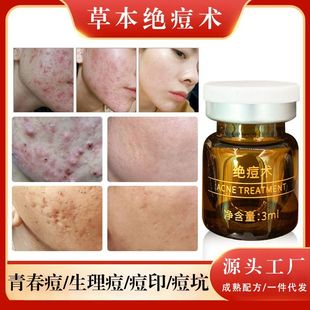 �ݱ��^���g΢��ȥ��ӡ�۴��ഺ�����o�ˮ����Ժ����AҺ���l