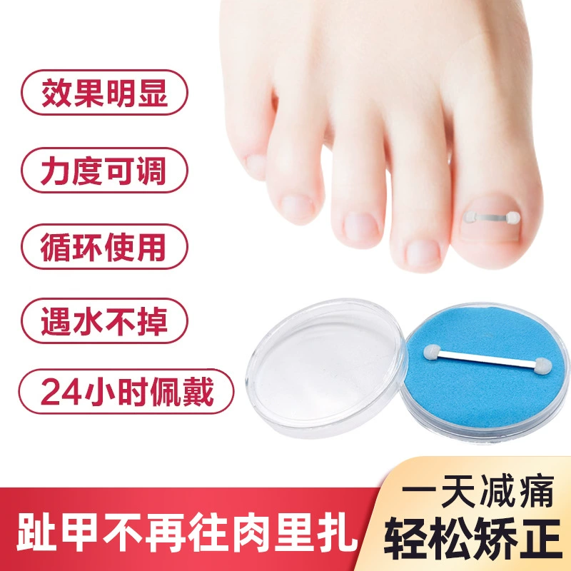 Наклейки для коррекции ногтей, полоски для коррекции ногтей, инструменты для коррекции ногтей, крючки для коррекции ногтей, зажимы для коррекции ногтей, коррекция ногтевых пазов, маникюр.