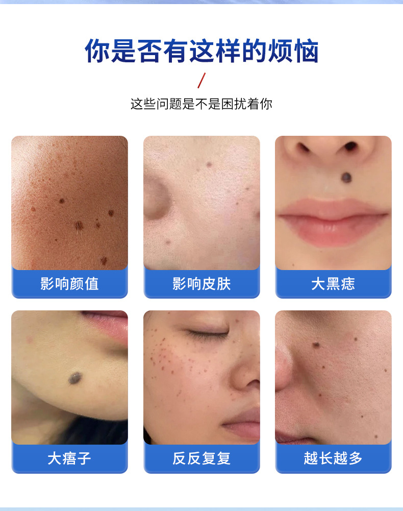 藤川健源点痣套装去黑痣面部痦子黑点斑点点痣膏套盒呵护舒缓皮肤-阿里巴巴